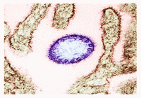 भारतमा निपाह भाइरस संक्रमणकाे पुष्टि