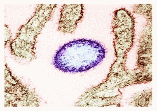 भारतमा निपाह भाइरस संक्रमणकाे पुष्टि