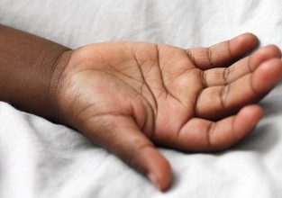 देशभरका चार सय २८ जनालाई निःशुल्क कृत्रिम हात वितरण गरिने