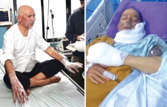उद्घाटनमा उडाउन लागिएको बेलुन विष्फोट हुँदा अर्थमन्त्री र मेयर घाइते