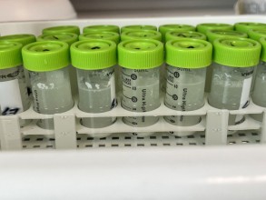 नर्वेली दूध कम्पनीले ‘एन्टिमिथेन’ पदार्थको प्रयोग स्थगित गर्ने