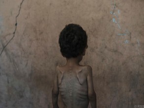 गाजामा ‘अनिकालको सबैभन्दा खराब अवस्था’ भइरहेको छ : खाद्य संकट विशेषज्ञहरू